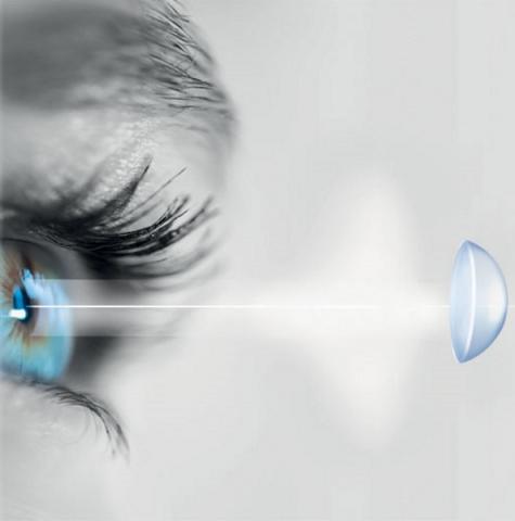 Adaptation lentilles de contact